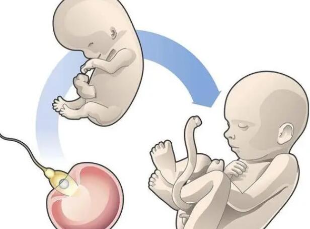 美国试管婴儿技术怎么样，掌握这三点一胎女宝也不难