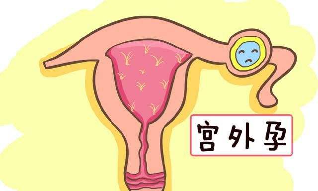 日本试管婴儿有哪些最快的流程，附上申请流程详解